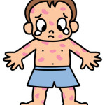 スキンケアによる肌かぶれのケア方法、予防法など スキンケアによる肌かぶれのケア方法、予防法など