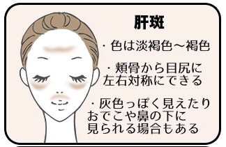 スクリーンショット 2015-07-30 8.44.22