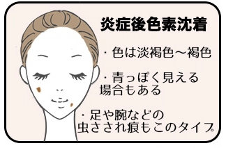 スクリーンショット 2015-07-30 8.44.50